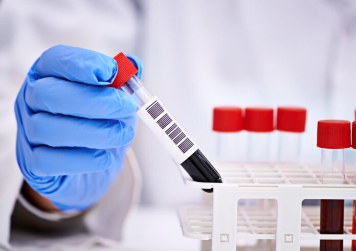 Предпринимателям Большого Подольска помогут снизить финансовые расходы при проведении сотрудникам тестирования на COVID-19