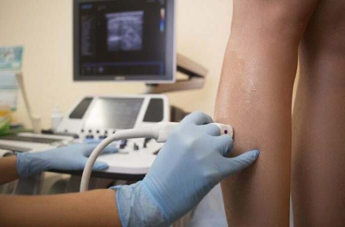 Эндовазальную лазерную коагуляцию вен нижних конечностей можно сделать в Подольске Эндовазальную лазерную коагуляцию вен нижних конечностей можно сделать в Подольске