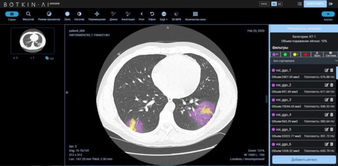 На платформе искусственного интеллекта Botkin.AI «Петровакс» и «Интеллоджик» запускают проект по исследованию препарата Лонгидаза®... На платформе искусственного интеллекта Botkin.AI «Петровакс» и «Интеллоджик» запускают проект по исследованию препарата Лонгидаза®...