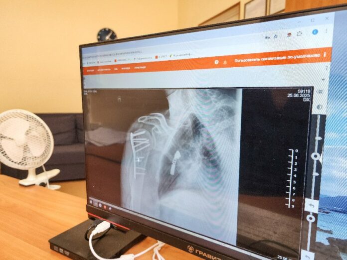 Подольские врачи делают инновационные операции при переломах